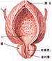 前列腺囊肿