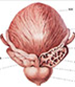 前列腺钙化