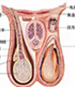 附睾炎